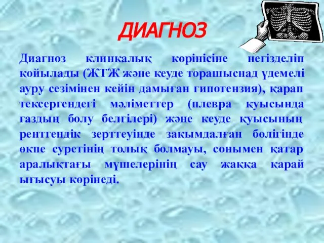 ДИАГНОЗ Диагноз клинкалық көрінісіне негізделіп қойылады (ЖТЖ және кеуде торашыснад үдемелі