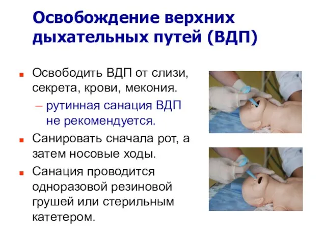 Освобождение верхних дыхательных путей (ВДП) Освободить ВДП от слизи, секрета, крови,