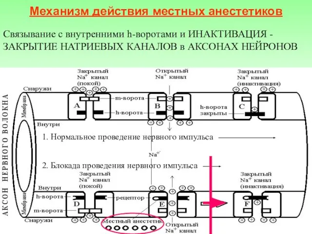 Механизм действия местных анестетиков Связывание с внутренними h-воротами и ИНАКТИВАЦИЯ -