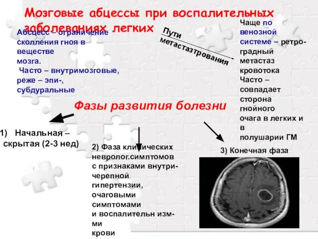 Мозговые абцессы при воспалительных заболеваниях легких Абсцесс – ограничение сколления гноя