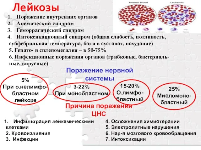 Лейкозы Поражение внутренних органов Анемический синдром Геморрагический синдром Интоксикационный синдром (общая