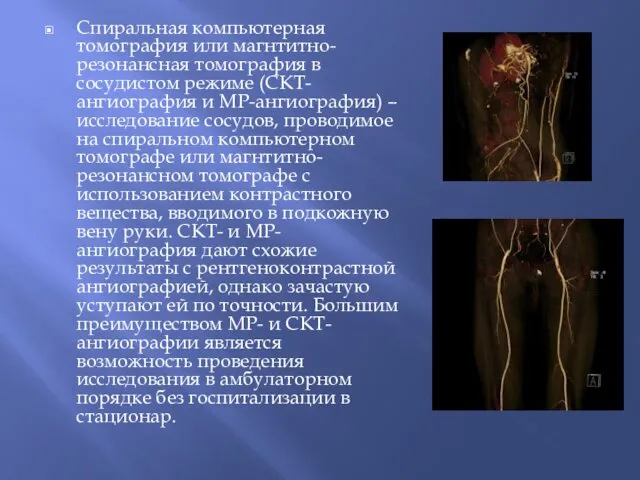 Спиральная компьютерная томография или магнтитно-резонансная томография в сосудистом режиме (СКТ-ангиография и