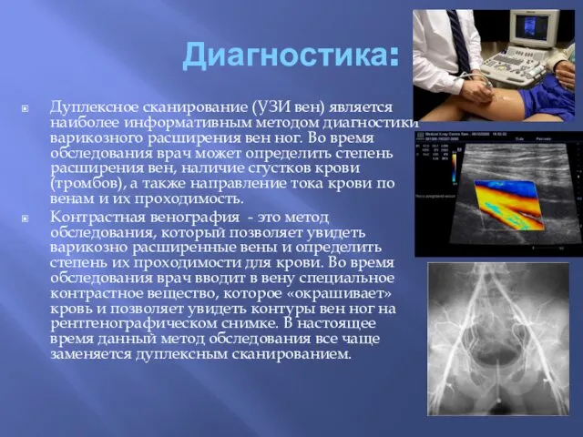 Диагностика: Дуплексное сканирование (УЗИ вен) является наиболее информативным методом диагностики варикозного