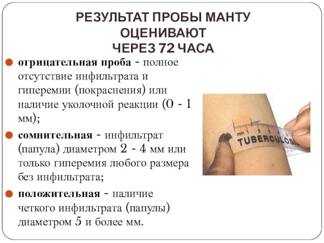 отрицательная проба - полное отсутствие инфильтрата и гиперемии (покраснения) или наличие