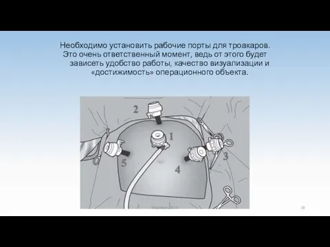 Необходимо установить рабочие порты для троакаров. Это очень ответственный момент, ведь