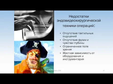 Недостатки эндовидеохирургической техники операций: Отсутствие тактильных ощущений Отсутствие фузии и чувства