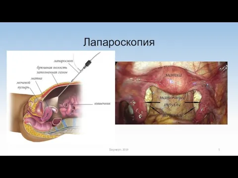 Лапароскопия Барнаул, 2019