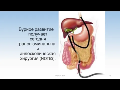 Бурное развитие получает сегодня транслюминальная эндоскопическая хирургия (NOTES). Барнаул, 2019