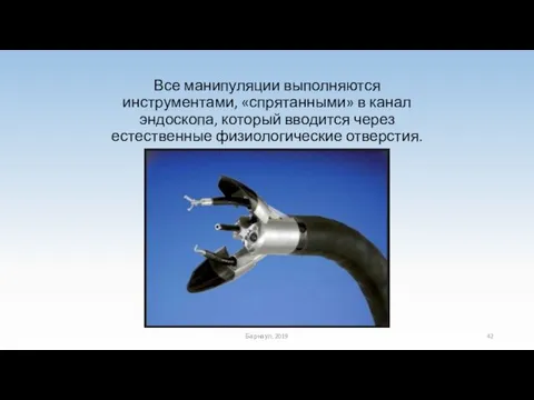 Все манипуляции выполняются инструментами, «спрятанными» в канал эндоскопа, который вводится через естественные физиологические отверстия. Барнаул, 2019