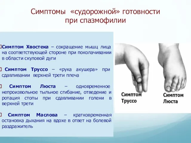 Симптомы «судорожной» готовности при спазмофилии Симптом Хвостека – сокращение мышц лица