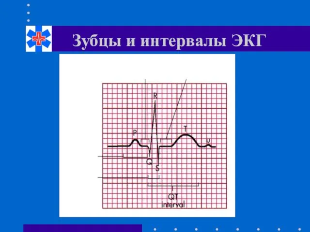 Зубцы и интервалы ЭКГ