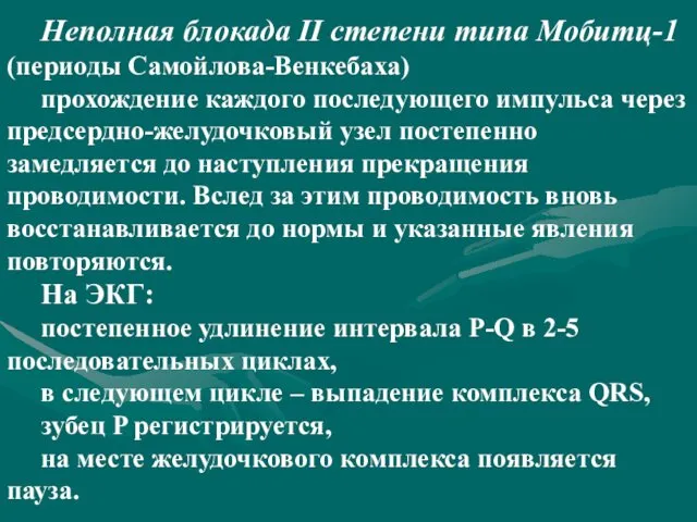 Неполная блокада II степени типа Мобитц-1 (периоды Самойлова-Венкебаха) прохождение каждого последующего