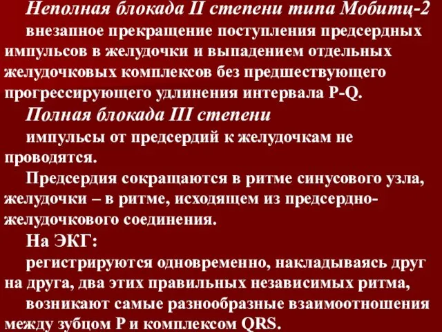 Неполная блокада II степени типа Мобитц-2 внезапное прекращение поступления предсердных импульсов