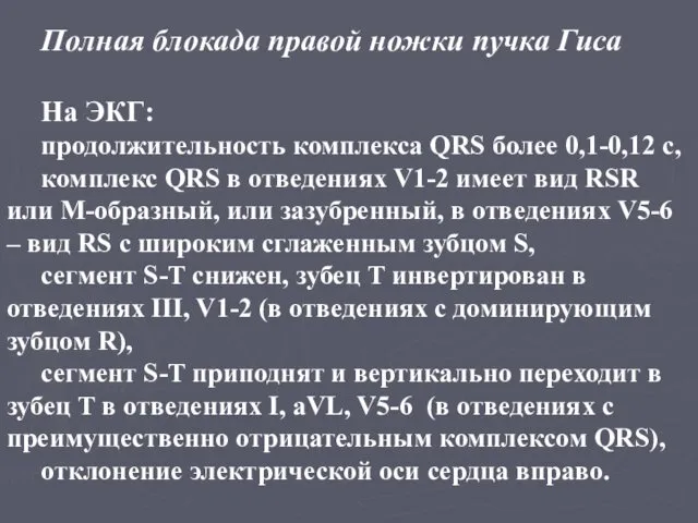 Полная блокада правой ножки пучка Гиса На ЭКГ: продолжительность комплекса QRS