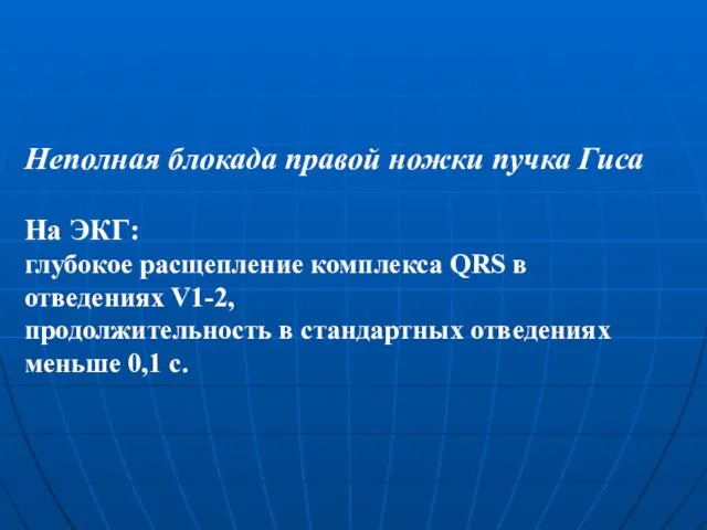 Неполная блокада правой ножки пучка Гиса На ЭКГ: глубокое расщепление комплекса