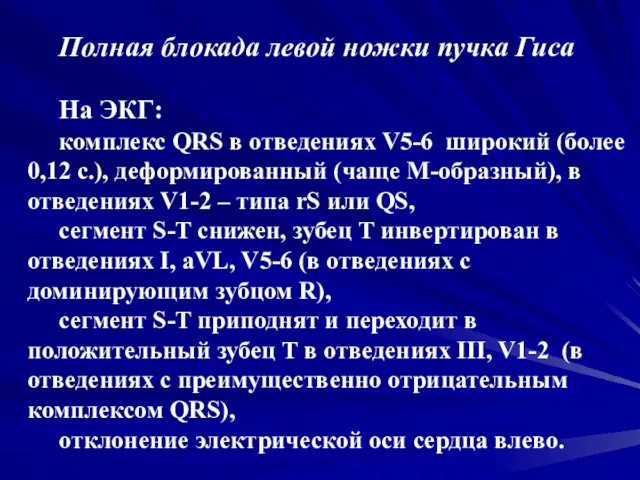 Полная блокада левой ножки пучка Гиса На ЭКГ: комплекс QRS в