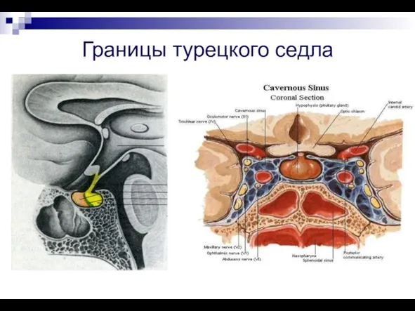 Границы турецкого седла