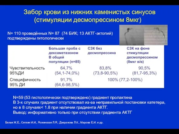 Забор крови из нижних каменистых синусов (стимуляции десмопрессином 8мкг) N= 110