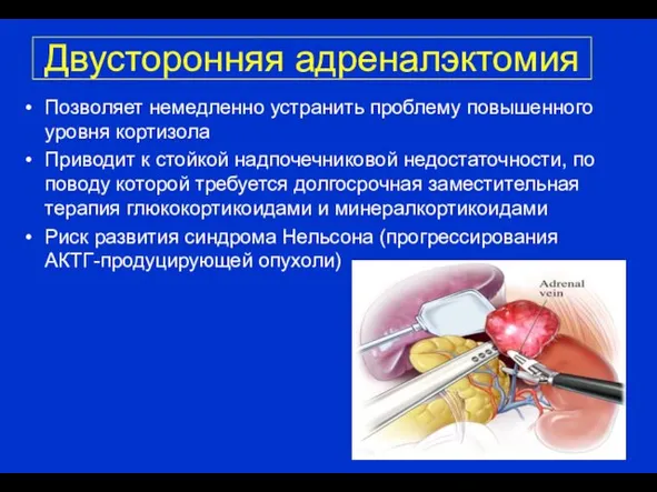 Двусторонняя адреналэктомия Позволяет немедленно устранить проблему повышенного уровня кортизола Приводит к