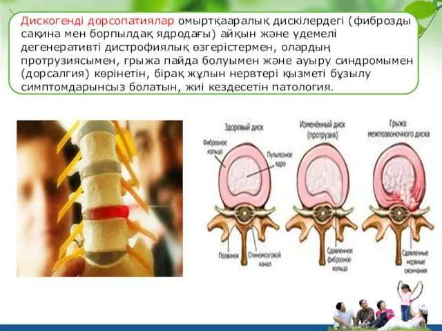 Дискогенді дорсопатиялар омыртқааралық дискілердегі (фиброзды сақина мен борпылдақ ядродағы) айқын және