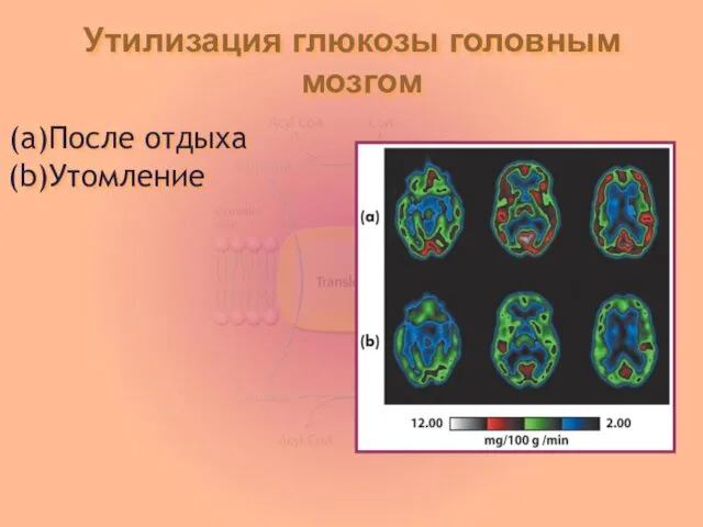 Утилизация глюкозы головным мозгом После отдыха Утомление