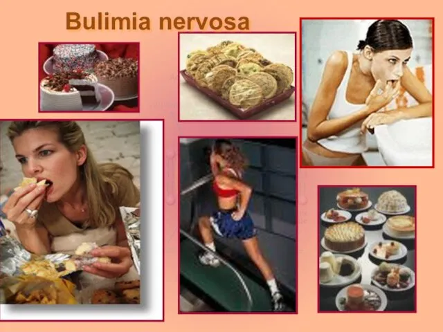 Bulimia nervosa