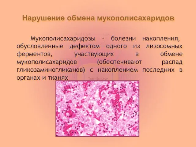 Нарушение обмена мукополисахаридов Мукополисахаридозы – болезни накопления, обусловленные дефектом одного из