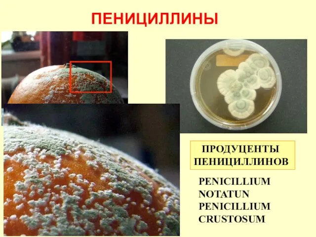 PENICILLIUM NOTATUN PENICILLIUM CRUSTOSUM ПЕНИЦИЛЛИНЫ ПРОДУЦЕНТЫ ПЕНИЦИЛЛИНОВ