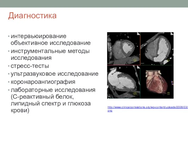 Диагностика интервьюирование объективное исследование инструментальные методы исследования стресс-тесты ультразвуковое исследование коронароангиография