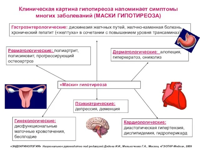 «Маски» гипотиреоза Дерматологические: алопеция, гиперкератоз, онихолиз Психиатрические: депрессия, деменция Кардиологические: диастолическая