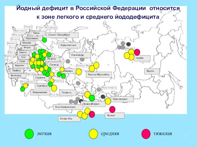 легкая средняя тяжелая Йодный дефицит в Российской Федерации относится к зоне легкого и среднего йододефицита 7