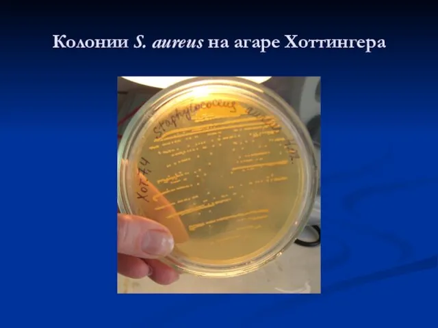 Колонии S. aureus на агаре Хоттингера