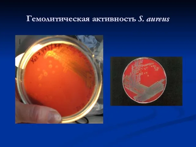 Гемолитическая активность S. aureus