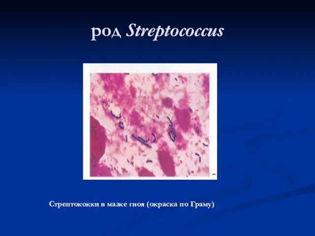 род Streptococcus Стрептококки в мазке гноя (окраска по Граму)