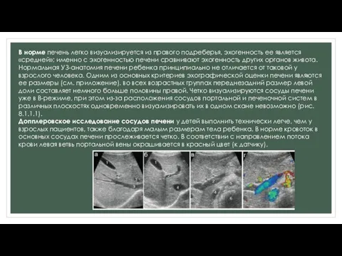 В норме печень легко визуализируется из правого подреберья, эхогенность ее является