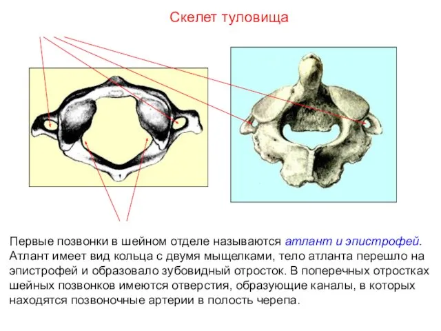 Первые позвонки в шейном отделе называются атлант и эпистрофей. Атлант имеет