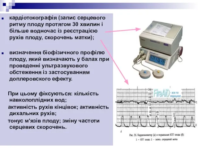 кардіотокографія (запис серцевого ритму плоду протягом 30 хвилин і більше водночас