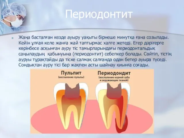 Периодонтит Жаңа басталған кезде ауыру уақыты бірнеше минутқа ғана созылады. Кейін