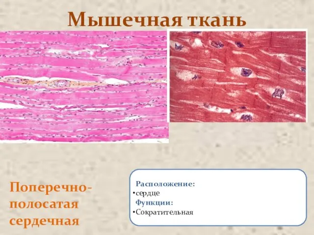 Мышечная ткань Поперечно-полосатая сердечная Расположение: сердце Функции: Сократительная