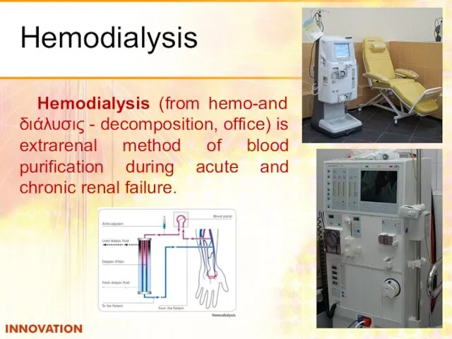 Hemodialysis Hemodialysis (from hemo-and διάλυσις - decomposition, office) is extrarenal method