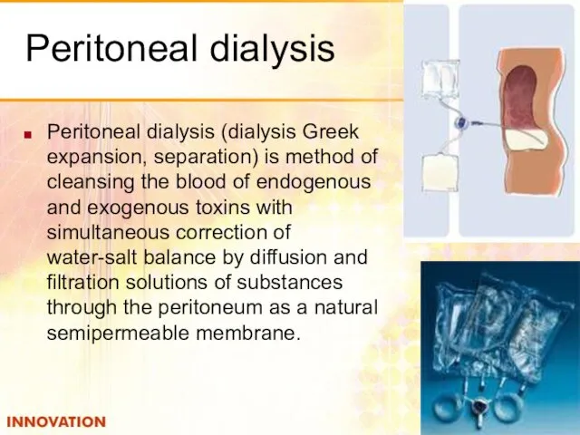 Peritoneal dialysis Peritoneal dialysis (dialysis Greek expansion, separation) is method of