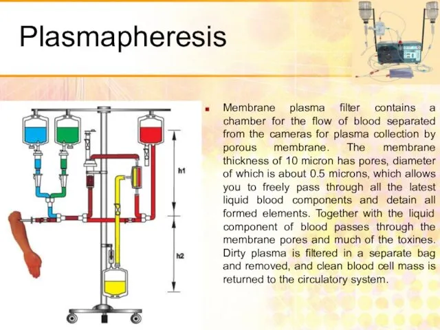 Plasmapheresis Membrane plasma filter contains a chamber for the flow of