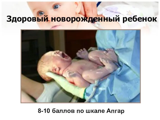Здоровый новорожденный ребенок 8-10 баллов по шкале Апгар
