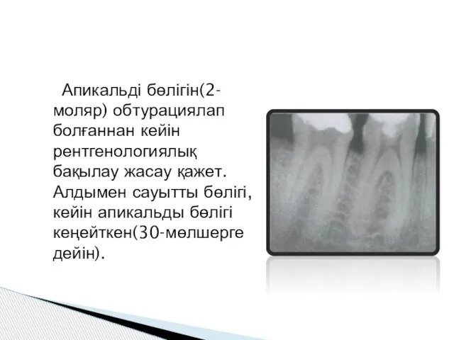 Апикальді бөлігін(2-моляр) обтурациялап болғаннан кейін рентгенологиялық бақылау жасау қажет. Алдымен сауытты