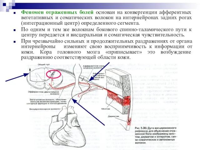 Феномен отраженных болей основан на конвергенции афферентных вегетативных и соматических волокон