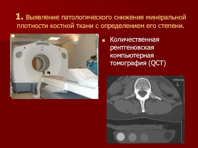 1. Выявление патологического снижения минеральной плотности костной ткани с определением его