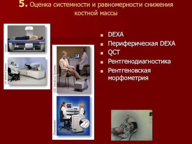 5. Оценка системности и равномерности снижения костной массы DEXA Периферическая DEXA QCT Рентгенодиагностика Рентгеновская морфометрия