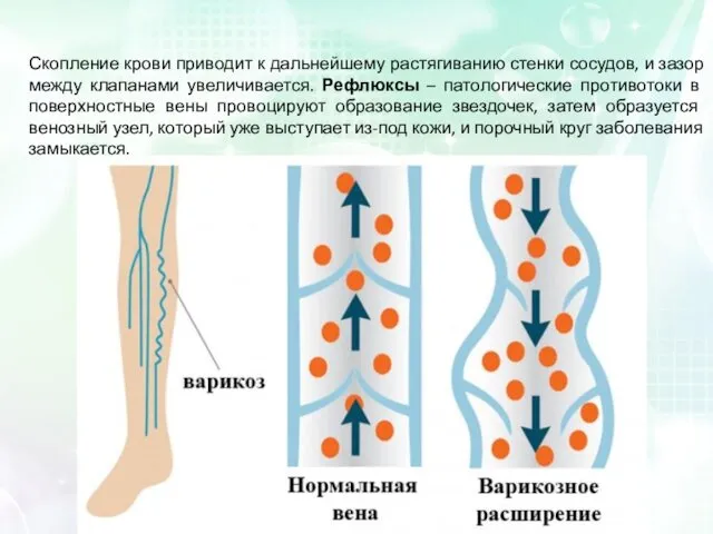 Скопление крови приводит к дальнейшему растягиванию стенки сосудов, и зазор между