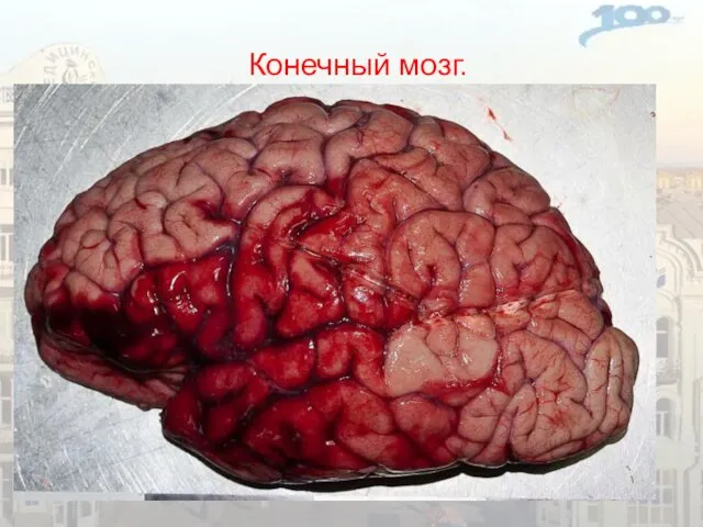 Конечный мозг. Мозговой центр, или корковый конец анализатора, имеет не строго