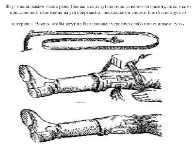 Жгут накладывают выше раны (ближе к сердцу) непосредственно на одежду, либо